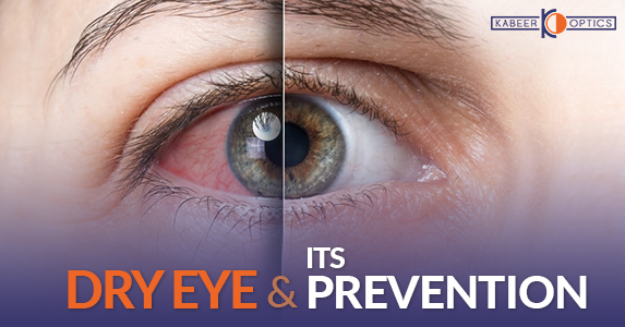 Dry eye and its preventions